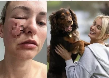 ยอมเจ็บแต่จบ! เปิดเบื้องหลังเจ้าของใจสลาย ตัดใจการุณยฆาตสุนัขแสนรักหลังถูกกัดปางตาย ชี้คือความรับผิดชอบสูงสุดต่อสังคม