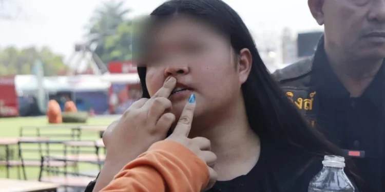 เหยื่อแชร์ศัลยกรรม ร้อง ปคบ. คลินิกนนทบุรีทำปากเบี้ยว