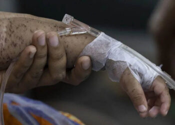 Hundreds of children die within months as measles cases soar in Bangladesh