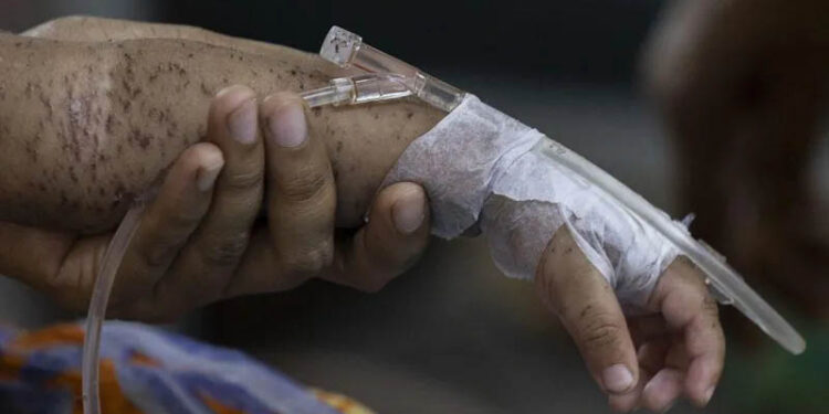 Hundreds of children die within months as measles cases soar in Bangladesh
