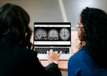 Doctors Suspected Brain Cancer In Spanish Man With Chronic Headaches. Scans Revealed Otherwise