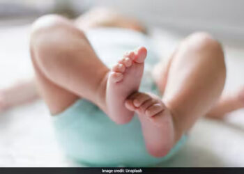 One-Year-Old Receives Treatment For Rare Skull Condition In World First 4 One-Year-Old Receives Treatment For Rare Skull Condition In World First
