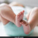 One-Year-Old Receives Treatment For Rare Skull Condition In World First