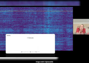 Speech-Impaired Man Uses Brain Implant To Say “I Love You”, Video Viral